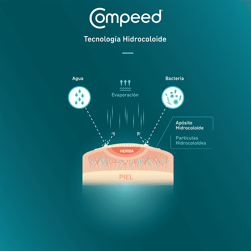 Compeed Hydrocolloid Technology Info graphic