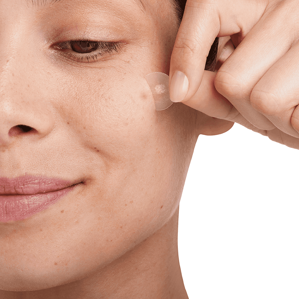 Woman taking off pimple patch